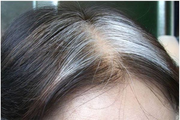 梦见自己长白头发意味着什么?