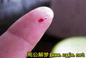梦见手指流血 手指出血
